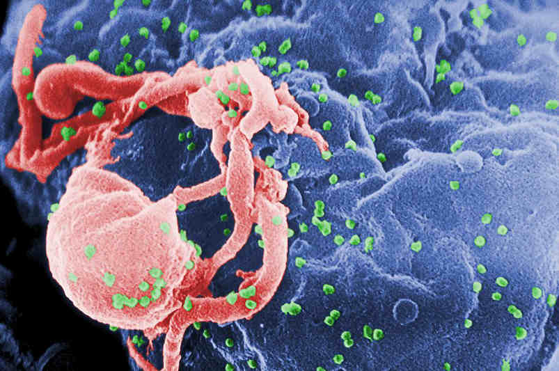 Estudo norte-americano revela que gays negros têm mais risco de contrair HIV que héteros brancos