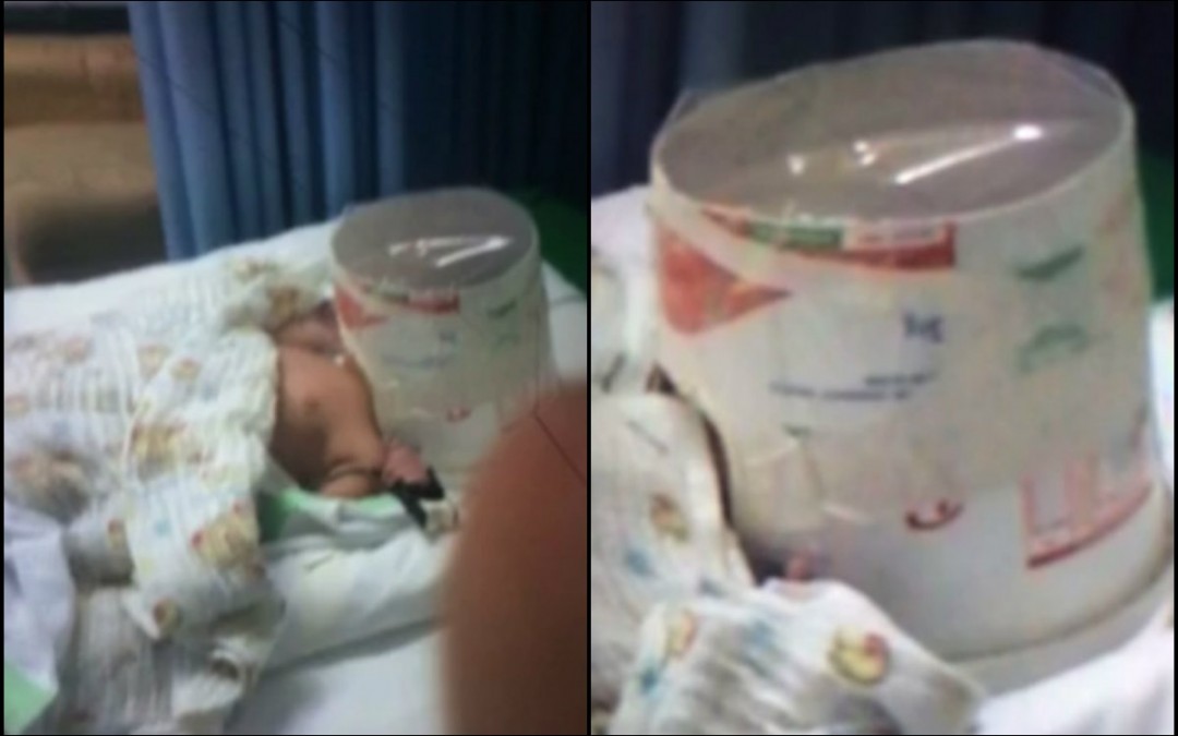Médicos salvam bebê usando balde de margarina, em Natal