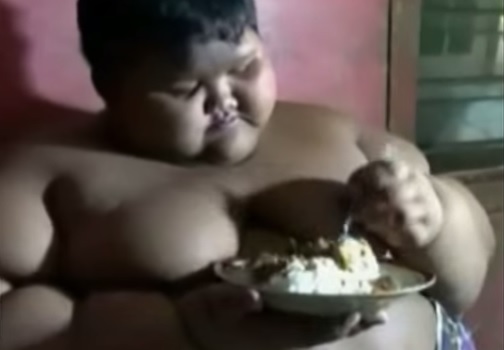 Menino de 10 anos entra em dieta ao atingir 192 kg, na Índia