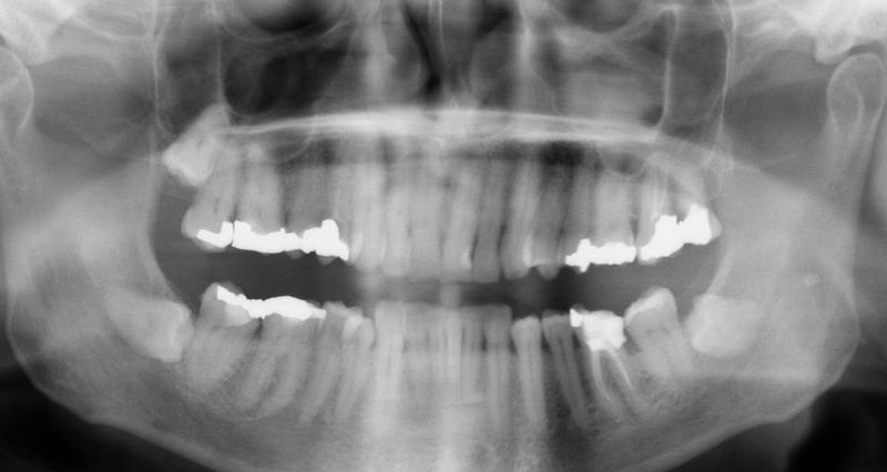 Aplicativo brasileiro ajuda dentistas a ler raios x