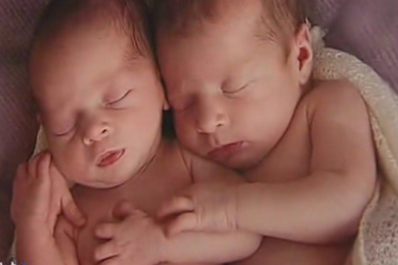 Mulher dá à luz filhas de duas gravidezes diferentes