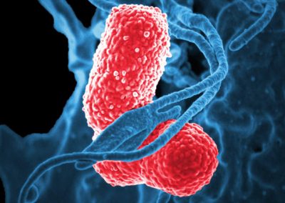 Bactérias identificadas em asmáticos poder deter cura para a doença
