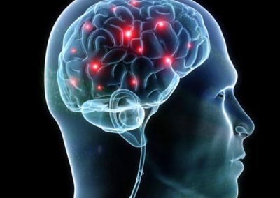 Peça chave para cura do Parkinson pode ter sido descoberta