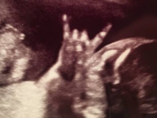 Bebê “do rock” surpreende em ultrassonografia