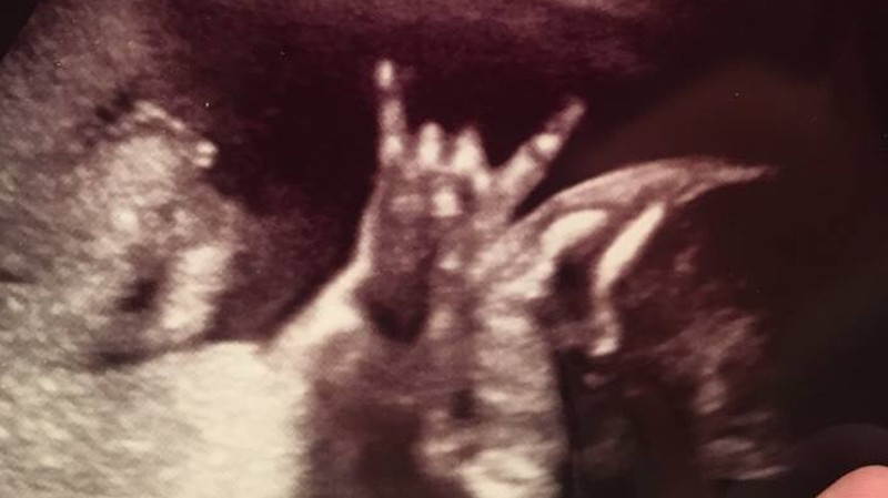 Bebê “do rock” surpreende em ultrassonografia