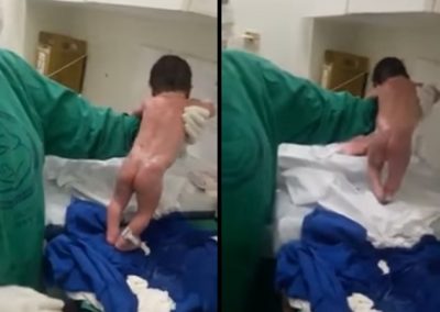 Com minutos de nascida, bebê já “levanta e anda”