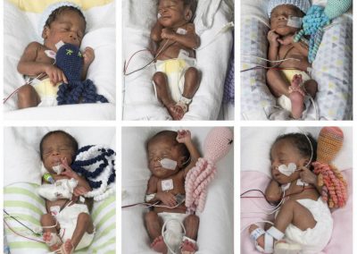 Mulher tenta engravidar por 17 anos e dá à luz sêxtuplos