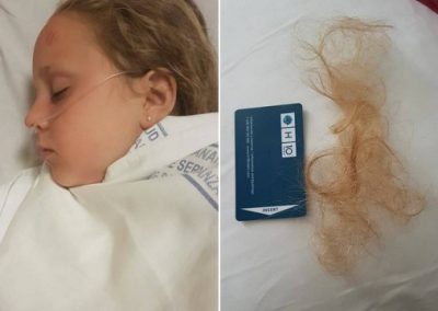 Garota é internada após ter cabelo sugado em filtro de piscina