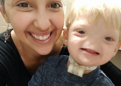 Bebê que nasceu sem nariz morre aos 2 anos de idade