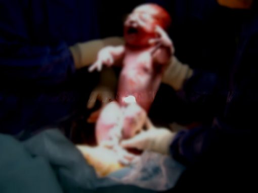Médica grávida sofre aborto espontâneo enquanto fazia cesárea em paciente