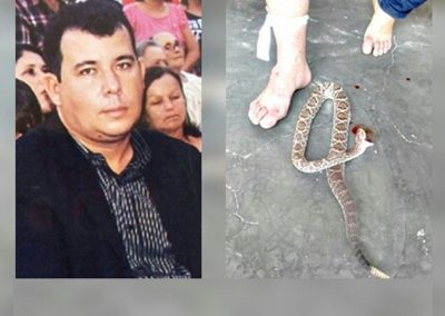 Vereador picado por cascavel mata cobra com dentada e vai dirigindo normalmente a hospital