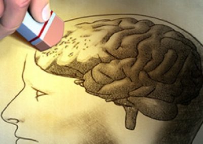 Pesquisa busca idosos com Alzheimer em estágio leve