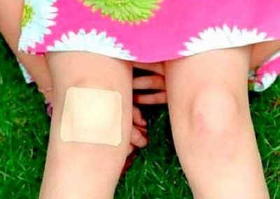 Beijo de mãe: estudo atesta efeito cicatrizante da saliva