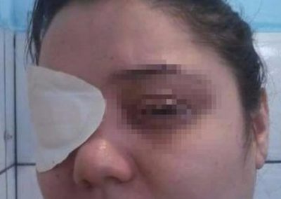 Mulher é presa por fingir doença para ganhar doações