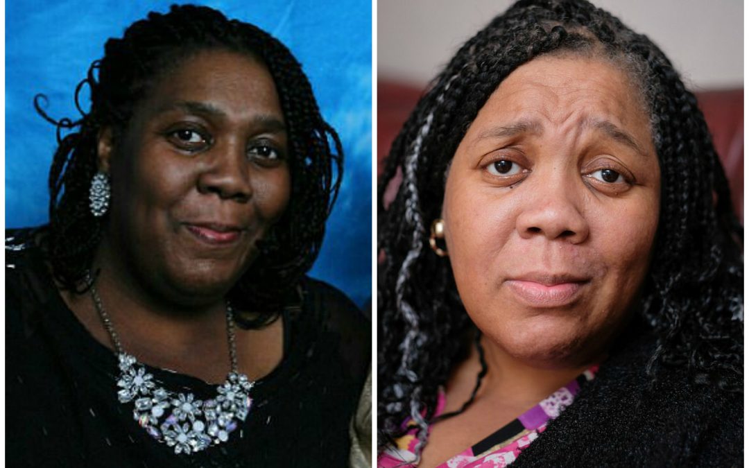 Remédio contra câncer faz mulher negra perder cor da pele