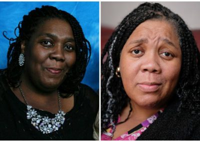 Remédio contra câncer faz mulher negra perder cor da pele