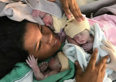 Após dar à luz trigêmeas de parto normal, brasileira diz não ter sentido dor