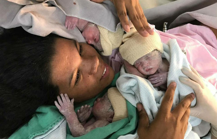 Após dar à luz trigêmeas de parto normal, brasileira diz não ter sentido dor