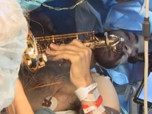 Músico toca saxofone durante cirurgia cerebral