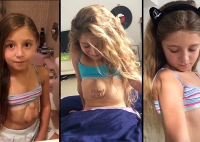 Vídeos de menina cujo coração bate “fora do peito” emociona internautas