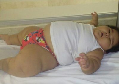 Bebê engorda 30kg em apenas 10 meses e pais buscam tratamento