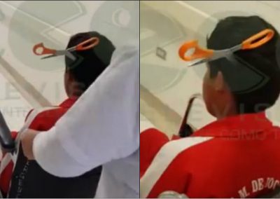 Após briga, menina crava tesoura na cabeça de colega de classe