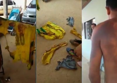 Homem é atingido por raio, mas recebe alta no mesmo dia