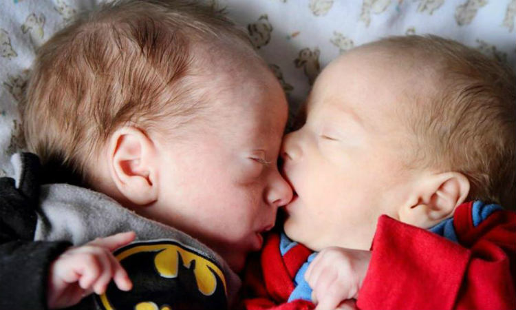 Em gravidez de risco, gêmeos se salvam de morte por ficarem abraçados