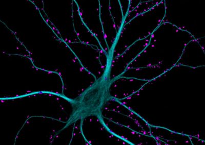 Descoberto mecanismo cerebral capaz de inibir pensamentos indesejados