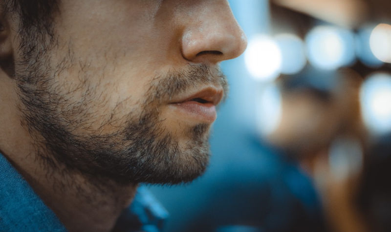 Transplante de barba já é realidade no Brasil
