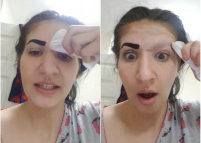 Garota perde a sobrancelha após usar produto que comprou na internet