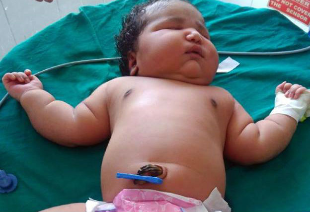 Nascimento de bebê gigante na Índia surpreende médicos