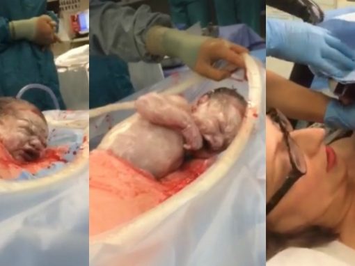 “Cesariana natural” faz bebê sair “arrastando-se” de útero, em técnica aplicada no Reino Unido