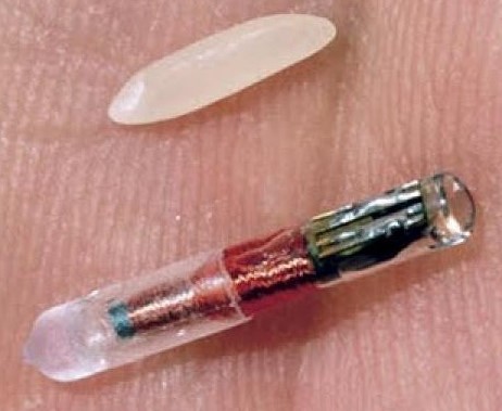 Empresa sueca oferece implante de microchip a funcionários