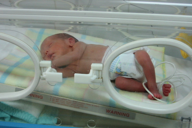 “Útero” artificial pode ser resposta para salvar bebês prematuros