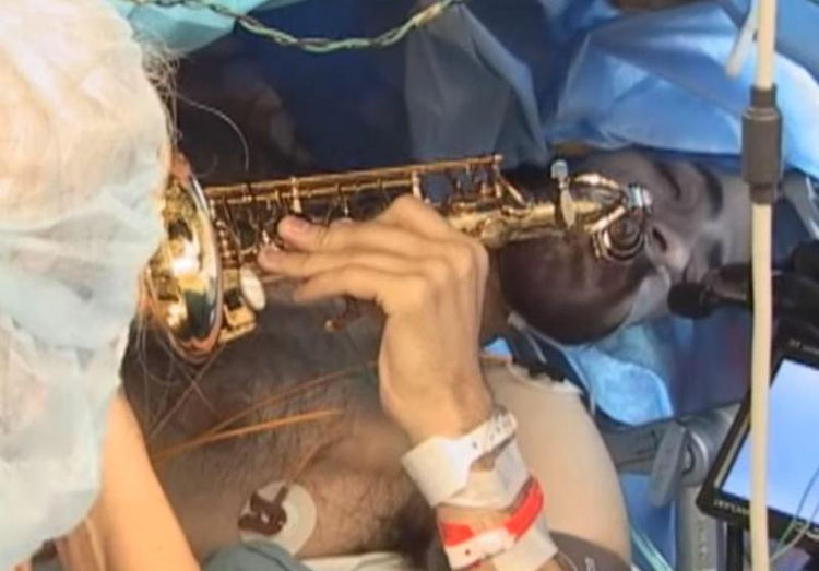 Músico toca saxofone durante cirurgia cerebral