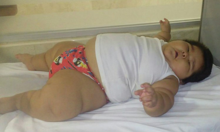 Bebê engorda 30kg em apenas 10 meses e pais buscam tratamento