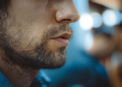 Transplante de barba já é realidade no Brasil